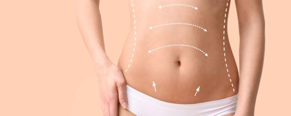 abdominoplastie